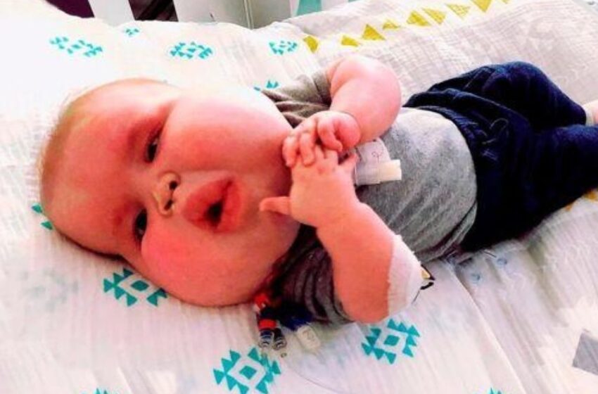  ¡Así Luce Hoy Este Niñito, Nacido con un Rostro Inusualmente Grande!: ¡Mira las Fotos!