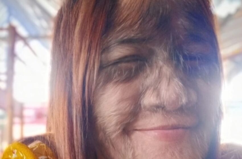 ¡La “Chica más peluda del mundo” ya es adulta y está locamente enamorada! ¡Mira su asombrosa transformación!