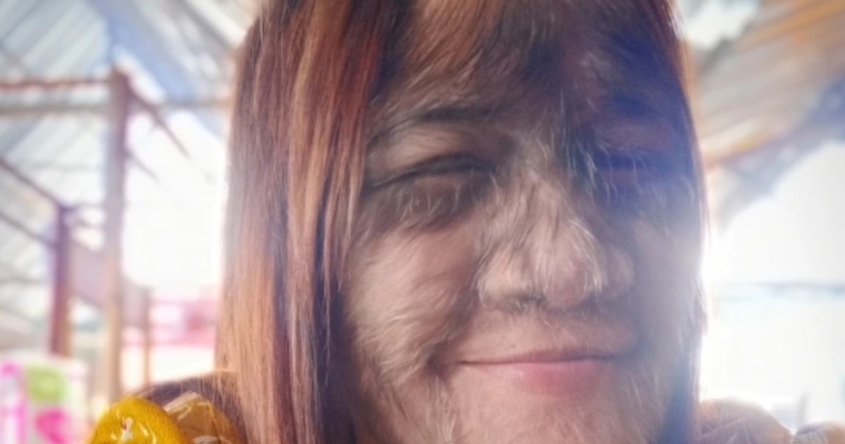 ¡La “Chica más peluda del mundo” ya es adulta y está locamente enamorada! ¡Mira su asombrosa transformación!