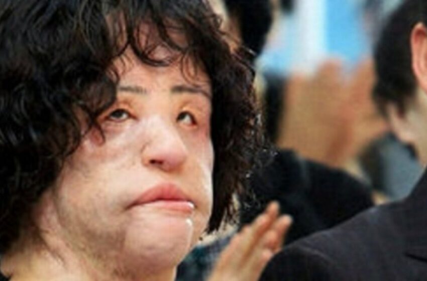  La sorprendente transformación de Hang Mioku: ¡la búsqueda de la belleza se convirtió en una pesadilla!