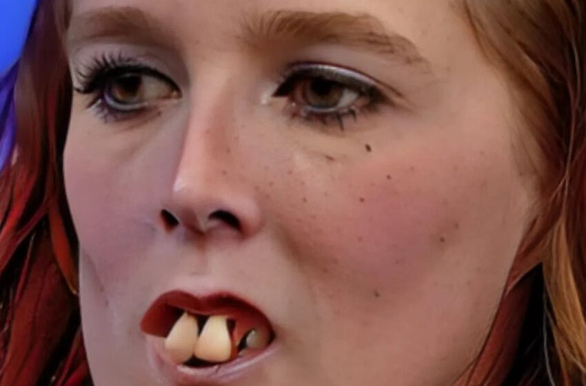  Famosa por su look único: ¡No vas a creer cómo se ve ahora después de una cirugía dental!