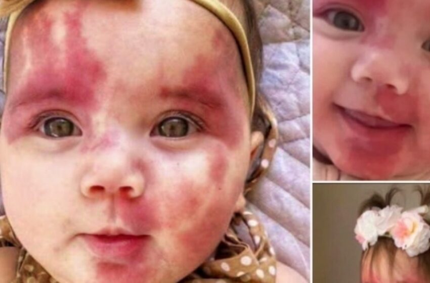  ¡Bebé llamada “Horrible” y “Defectuosa” sorprende a todos con su increíble transformación! ¡Mira las fotos!