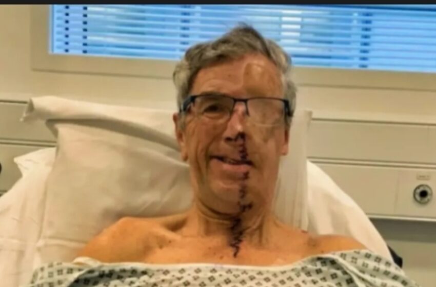  De la tragedia al triunfo: ¡El hombre que recibió el primer rostro impreso en 3D del NHS tras un accidente devastador!